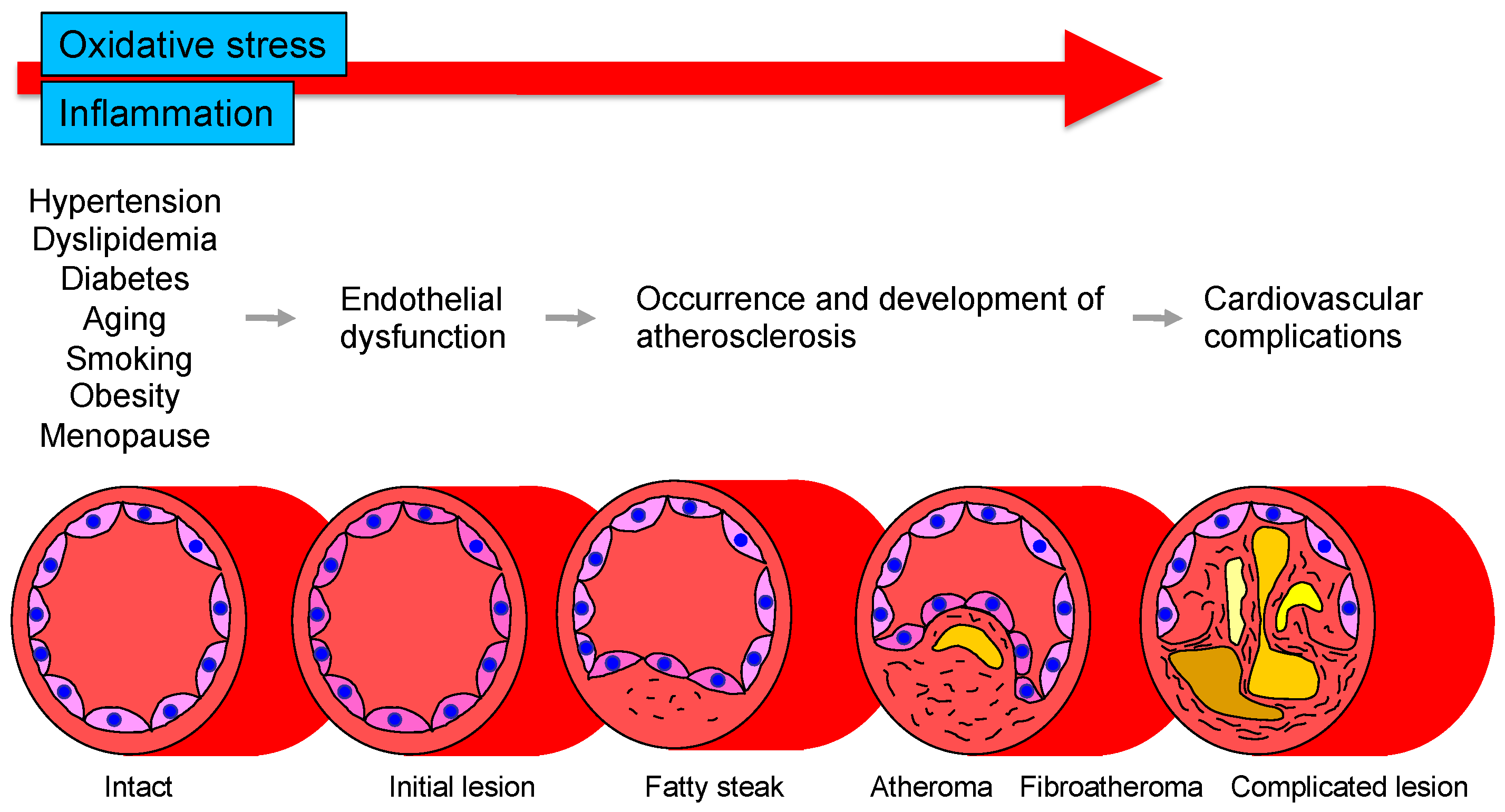 Vascular Endothelial Dysfunction Related Disease Encyclopedia Mdpi