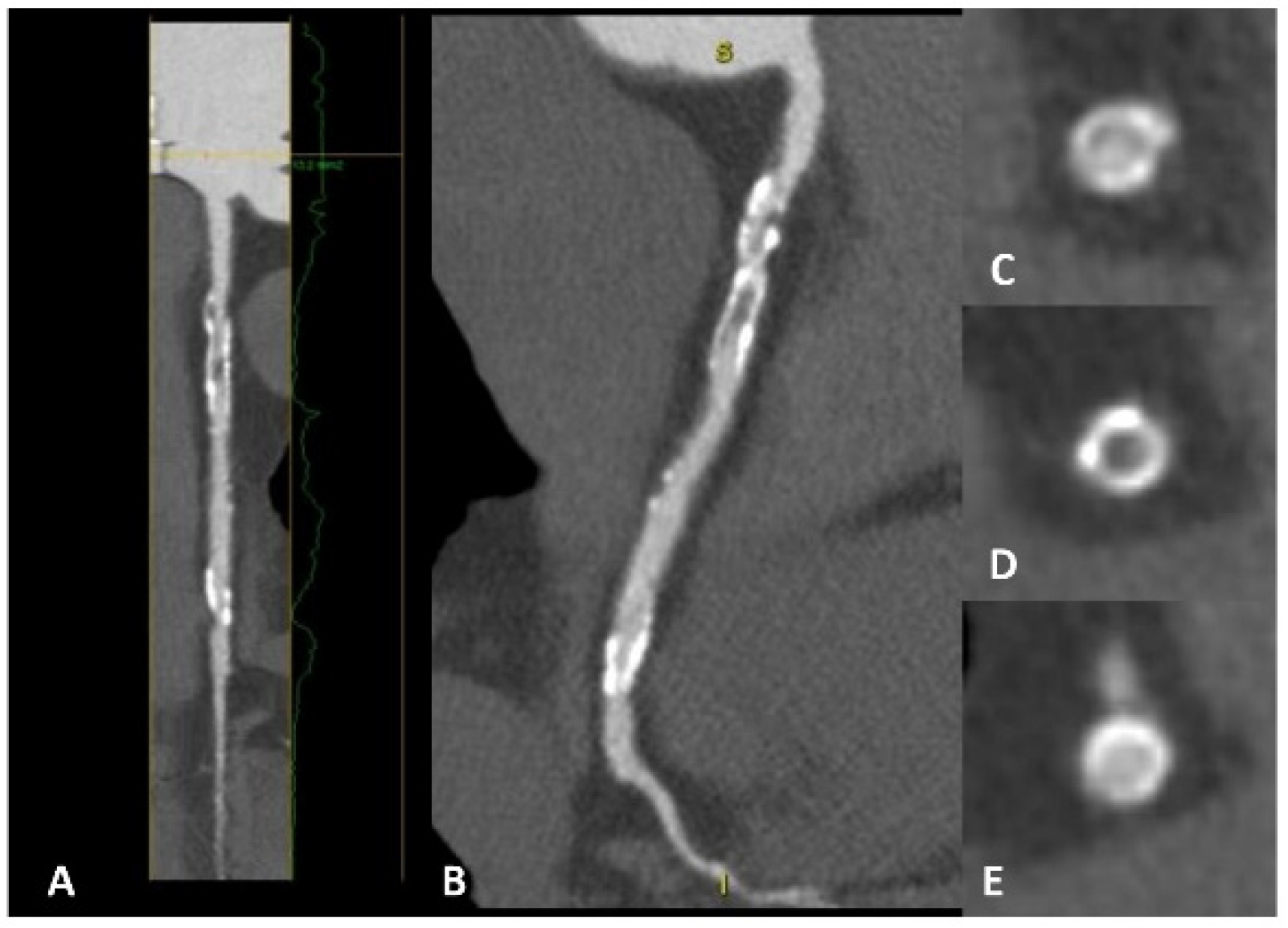 Jcm 12 05563 g005